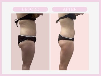 スリムライン 盛岡店(The Slim Line)/before→after