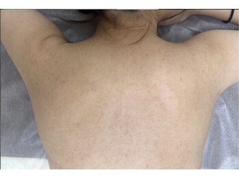 リベル 名古屋(Lebelle:)/ハーブピーリング専門 名古屋