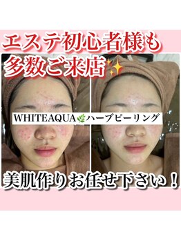 アルムダアクア 天王寺店(Aleumda AQUA)/ハーブピーリング/大阪/天王寺