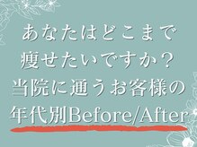 さくら通り美容整体院/Before/After