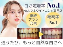 LBSホワイトニング 新宿店