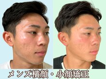 ナチュラルパーフェクトフェイス 新宿/メンズ横顔/新宿駅小顔矯正造顔