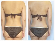 ヒーリングサロン ケリー(KELLY)/ビフォーアフター　30代お客様