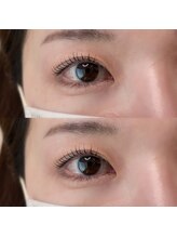 クイーンズ(Queens)/ラッシュリフト　宇都宮