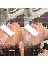 ハリオン 中目黒(HARI-ON)/初回　BeforeAfter