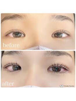 ビビデバビデ(Vivide Vavide)/ラッシュリフト【まつぱ】