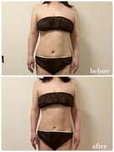 リリィブラン(Lily branc)/【痩身】上半身前面