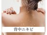 【背中の大人ニキビ悩みに】肌見せの季節到来/背中美人になる