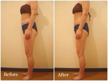 スキンセラピーサロン ル クレール(Le Clair)/Before→After