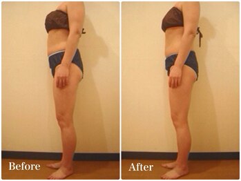 スキンセラピーサロン ル クレール(Le Clair)/Before→After