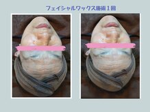 アンビー(Ann-Bee)の雰囲気（幅広い年代のお客様に違いをご実感いただけるメニューをご提案）