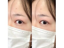 チュチュアチュチュ(chuchu a chuchu)の雰囲気（ダメージレス☆ブラックティント付き☆2ヶ月持続パーマ）