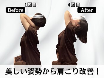 ハリユナイテッド 原宿鍼灸 整体院(HALI UNITED)/美しい姿勢から肩こり改善!