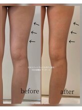 ルフ エステティック ビューティー(ruf esthetic beauty)/エキスパートマックスボディ