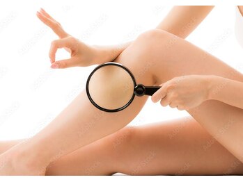 ローランパリス 新居浜店/肌が弱くても脱毛できます!