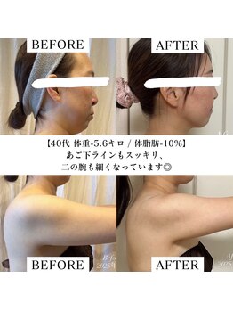 ヨサパーク サンテ 祐天寺(YOSA PARK sante)/痩身/ダイエット/よもぎ蒸し痩身