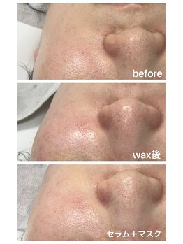 フォーカス(FOCUS)/艶肌wax