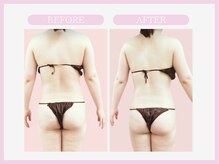 スリムライン 仙台店(The Slim Line)/before→after