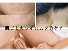 ビューティータワー(Beauty Tower)の雰囲気（デリケートゾーンの白髪にも、現在、未来の為の大切なケア）