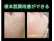 リオル(Rior)の写真/最速でツヤ肌×毛穴レス！ダウンTありハーブピーリング★劇的7日間で肌改善ができる人気No.1メニュー◎