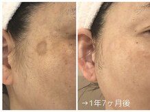 ビューティーサロン メイプルツリーの雰囲気(シミ改善はmapletreeにお任せください!)