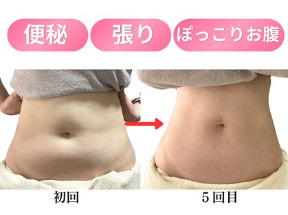 アノン 宮崎(anon)の写真