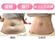 アノン 宮崎(anon)の写真