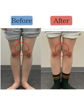 ステイゴールド美容整体院(STAY GOLD)/O脚矯正の効果