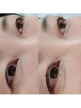 コア(Koa)/パリジェンヌアップリフト