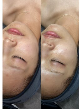 ニーナアイプラス(nina eye+)/