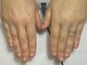 ミコ(.mico)の写真/【老若男女大歓迎！育爪、美爪、深爪、巻き爪】自信を持って人前に出せる手に！幅広い層から支持◎