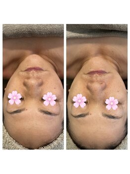 美温(mion)/インディバ×マーメイド