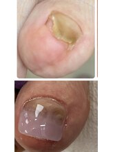 エンヴィ(ENVY)/お爪は作れます♪