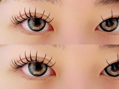 アコ バイ ネオリーブアイス(aco by Neolive ice)の写真