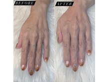 リリー(Lily)/ハンドスクラブ