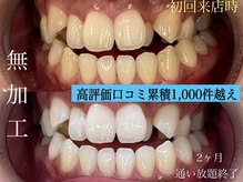 札幌セルフホワイトニング ラディアンス(Radiance)