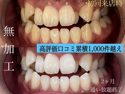 札幌セルフホワイトニング ラディアンス(Radiance)の写真