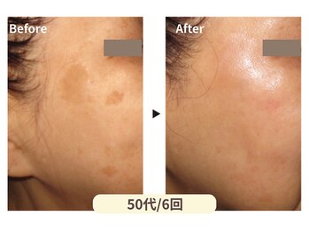 美男美女 奈良三条店/鏡を見るのが楽しみに