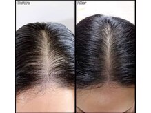 マーブル 熊本合志店/育毛促進【40代女性　分け目】