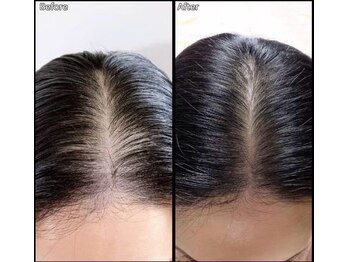 マーブル 熊本合志店/育毛促進【40代女性　分け目】