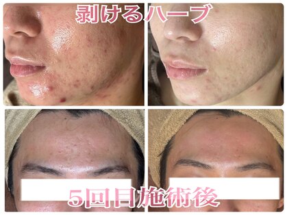 アブニールブリヨンの写真