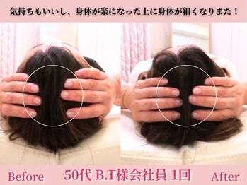 アメリイ 百合ヶ丘 新百合ヶ丘(Amerii)/【50代頭蓋骨矯正】1回身体整う