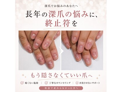 アウェイク ネイル(Awake Nail)の写真