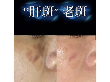 ポルテ バイ ハルモ(porte by Harmo)の写真