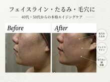 エステティックサロン アイム