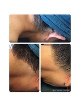 ディオーネ 湘南藤沢店(Dione)/長年のお悩みもお任せ！