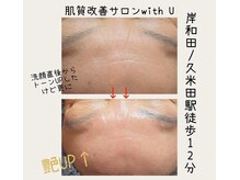 ウィズユー(with U)/BeforeAfter