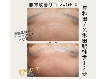 ウィズユー(with U)/BeforeAfter