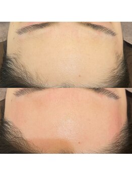 アトリエ ハルミナ(atelier harumina)/ツヤツヤおでこWax