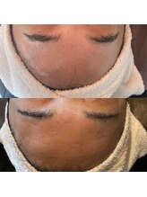 ココベラ(Cocovela)/松ヤニパックで驚きの潤い艶肌★